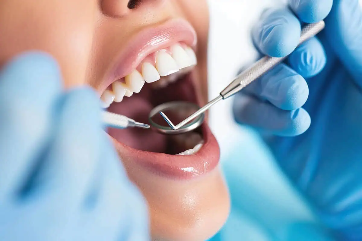 Cavity by dentalmedicalspa in unitedstates