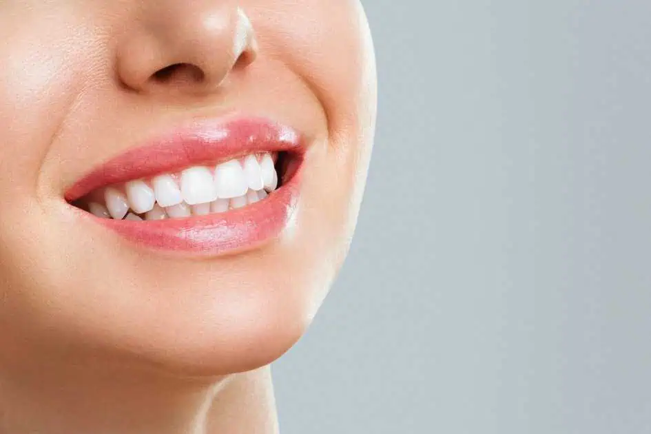 Zoom Whitening Treatment in Orlando, FL by Windermere Dental & Medical Spa