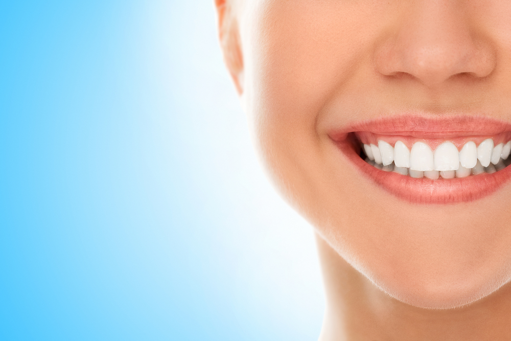 Who does a teeth cleaning in Orlando?
