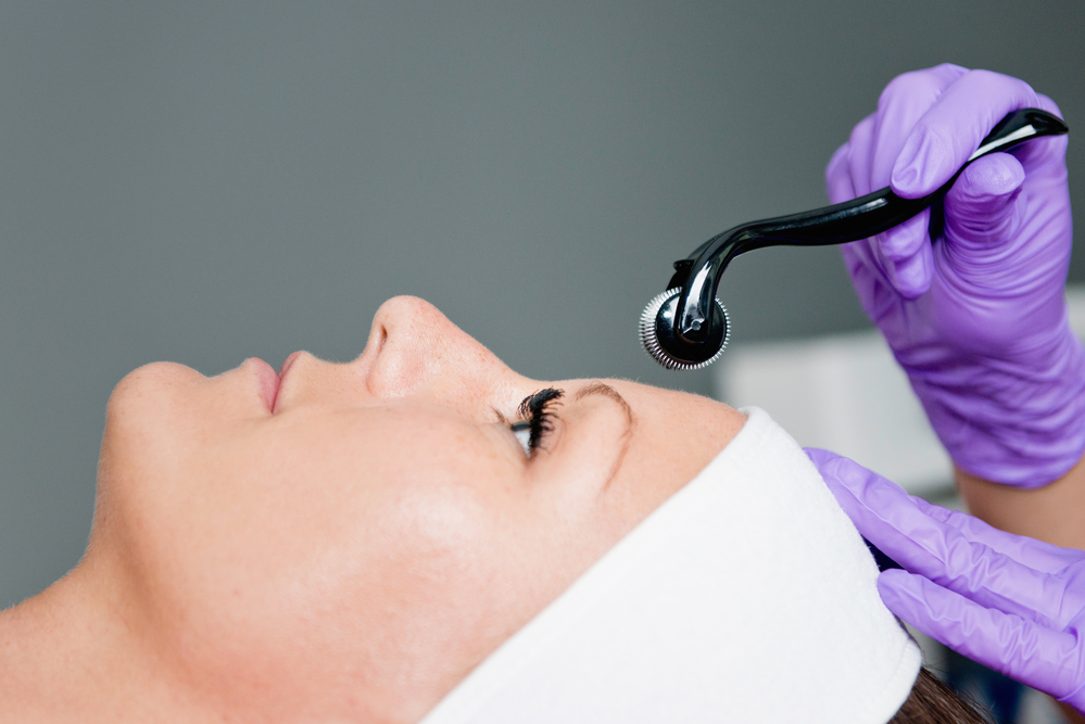 who is the best microneedling in orlando?
