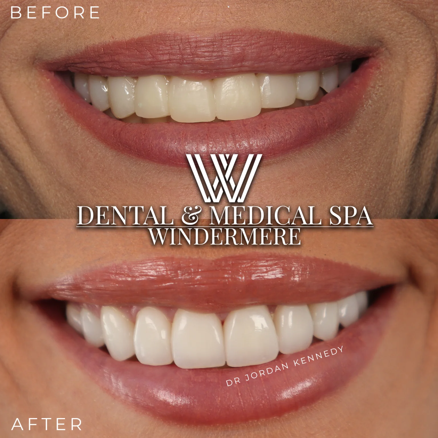 stephanie-brighter-dental-medical-spa-orlando-FL