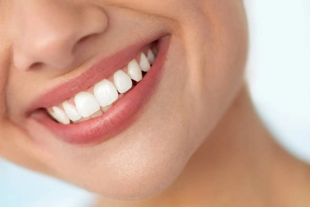zoom whitening by dental medicalspa in florida
